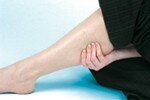 Swelling in legs and varicose veins